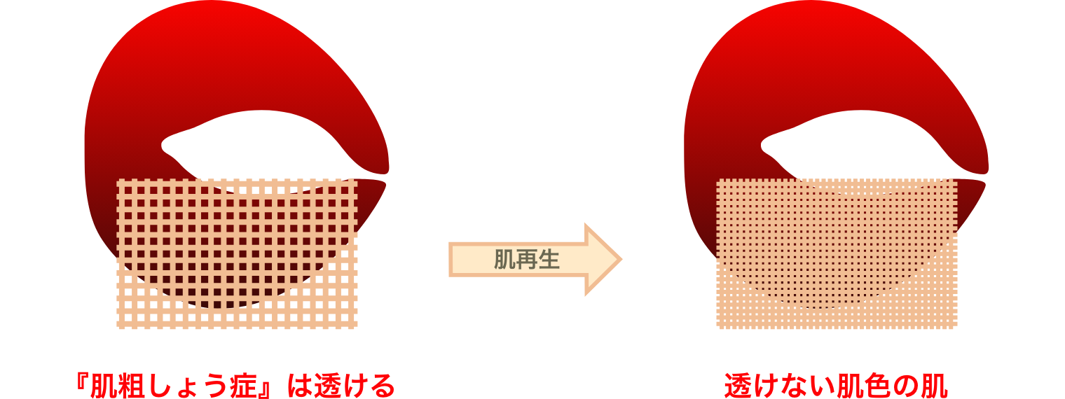 目のクマを改善する説明図