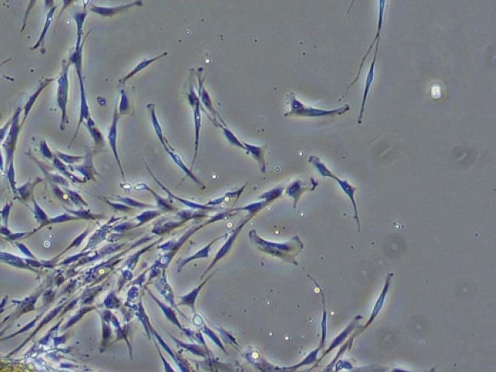 線維芽細胞イメージ