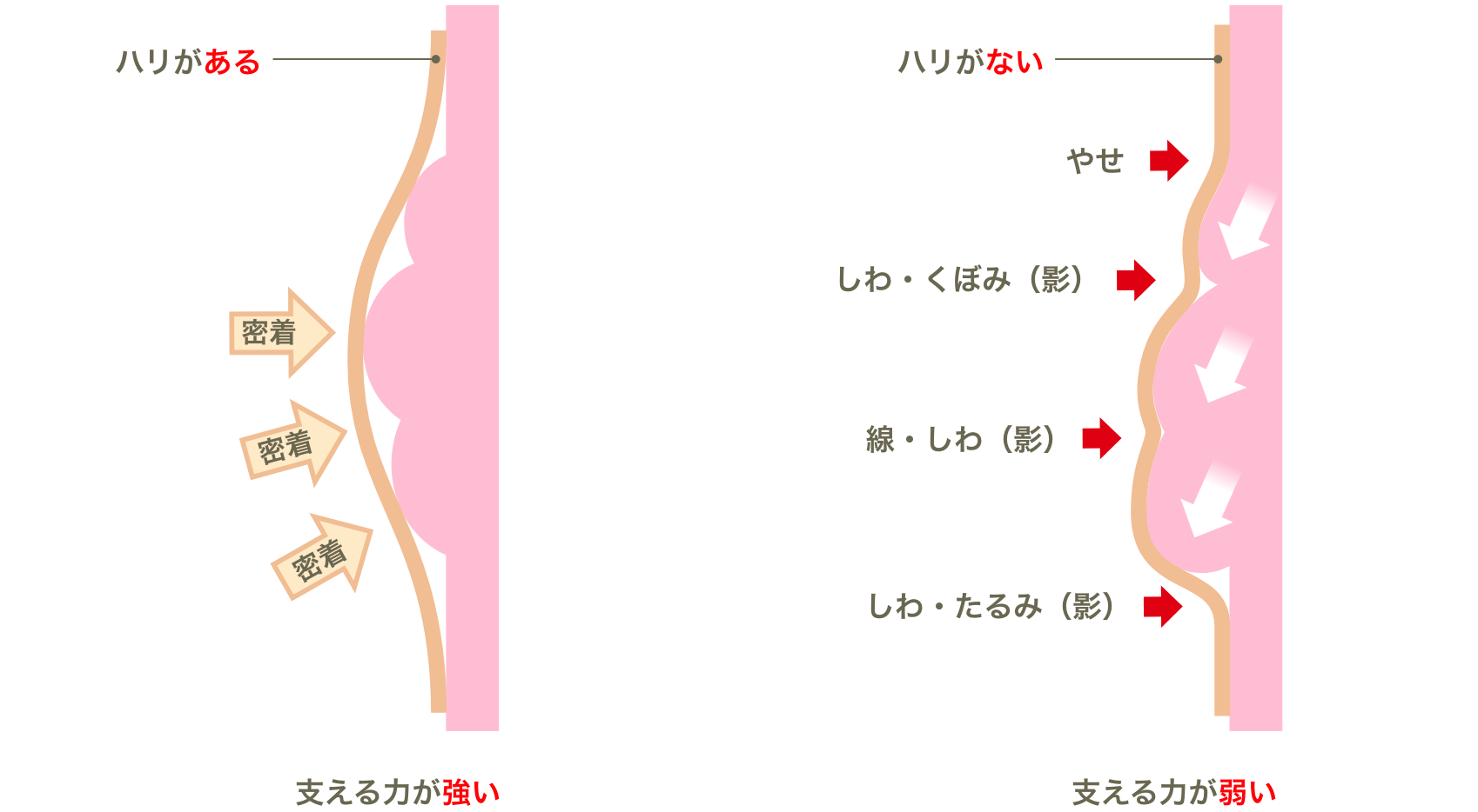 ハリのある肌とハリのない肌の脂肪を支える力の違いの図